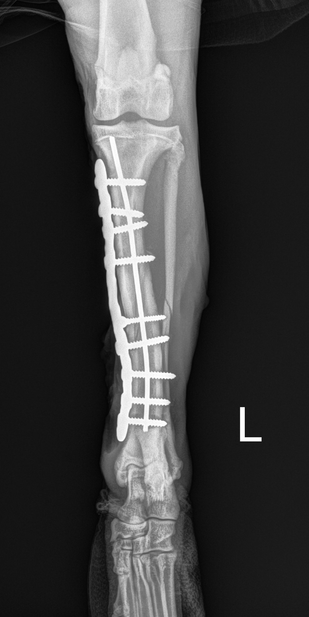 fracture repair 2